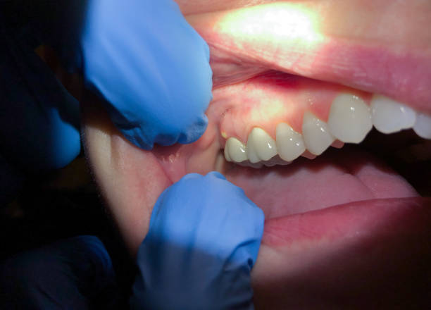 Best Broken or Chipped Tooth Repair in Galesville, WI