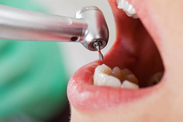 Best Emergency Root Canal Therapy in Galesville, WI